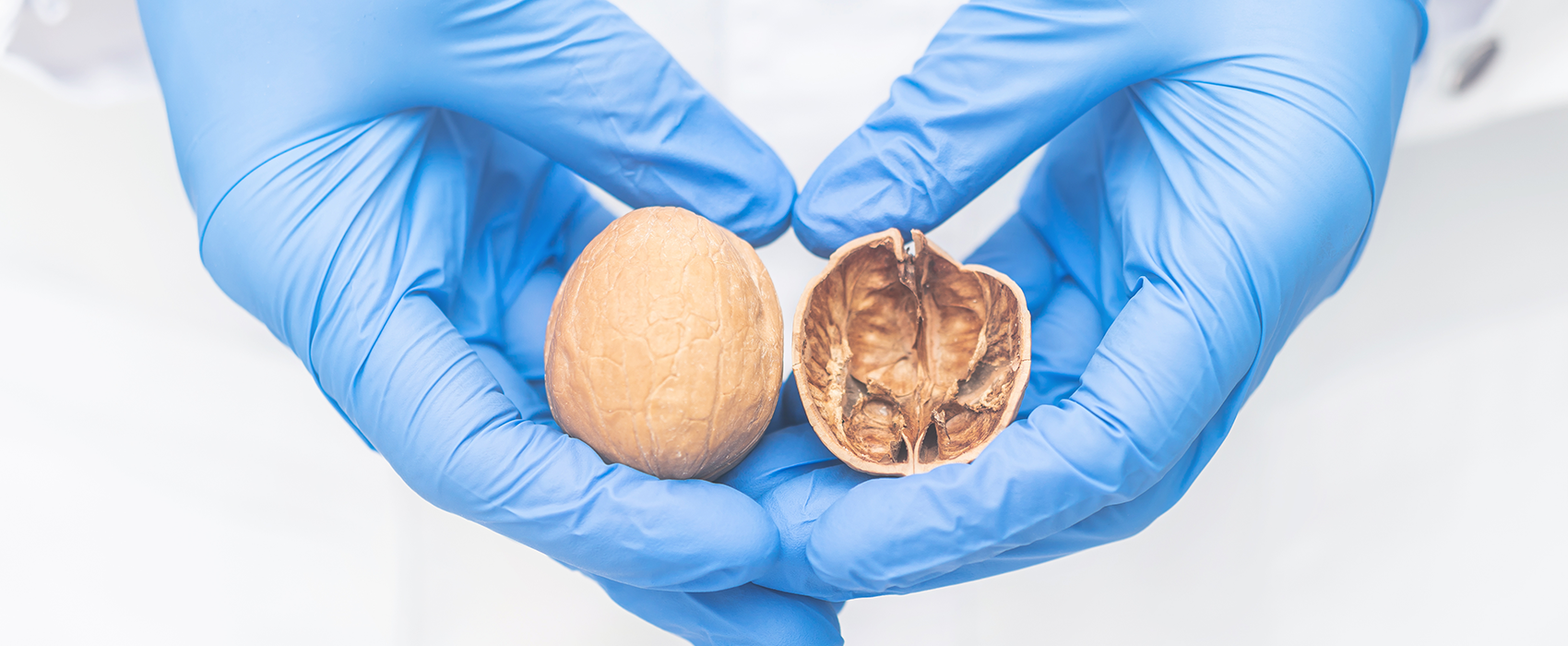 Testicular Cancer